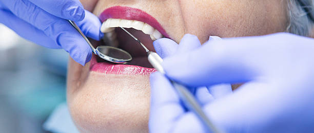 Best Emergency Dentist for Lost Fillings or Crowns in Caribou, ME